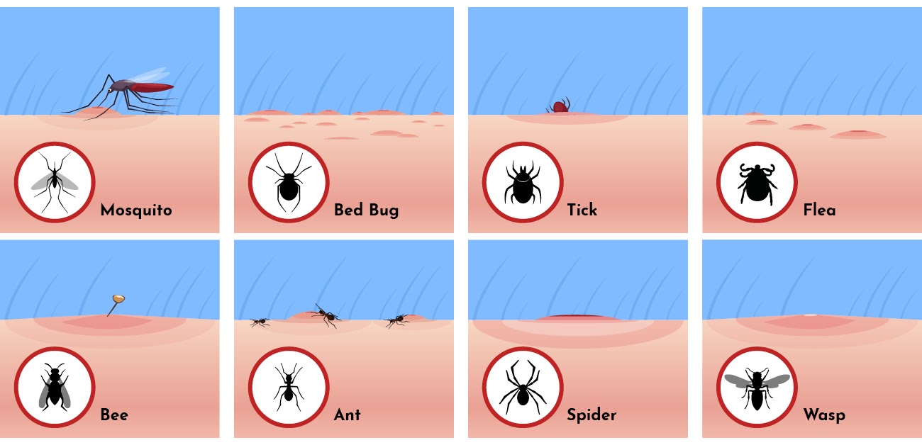 Spider Bites: Identify What Bit You and Get Proper Help